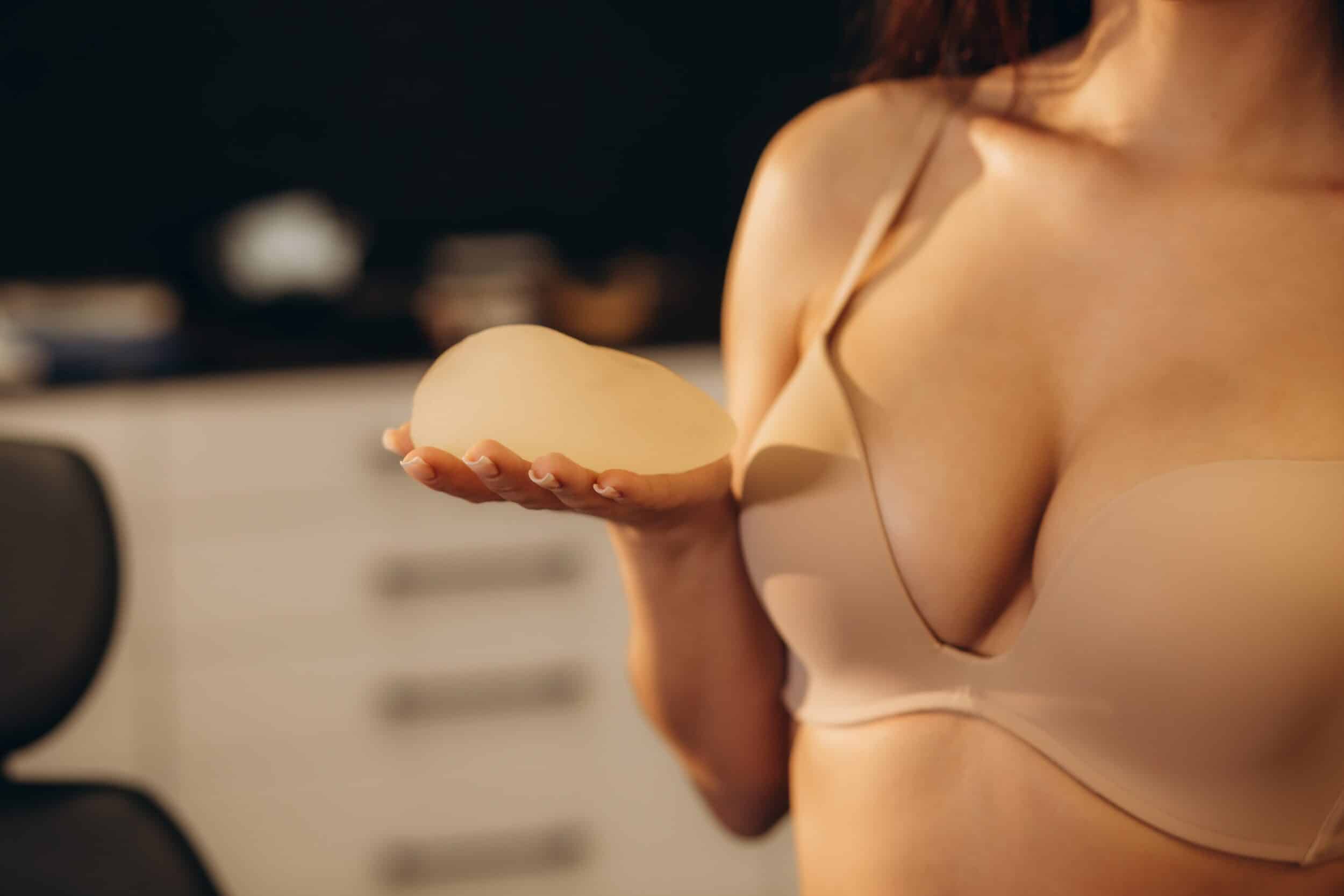 Woman in bra holding implant during consult for breast implant revision in Calgary